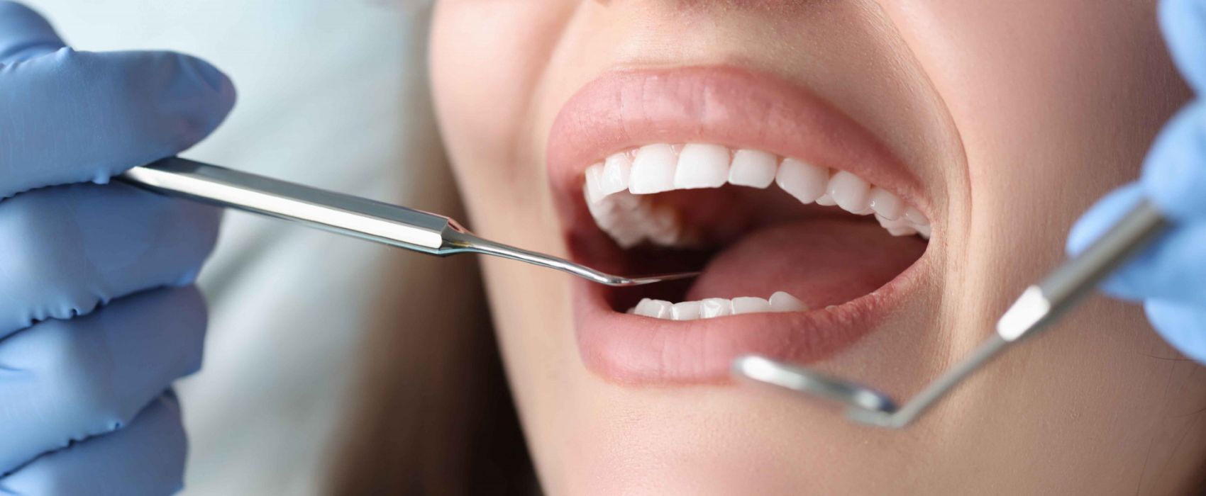 الحلول التجميلية والطبية للأسنان